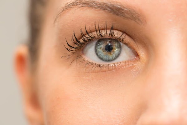 Causes of Chocolate Spots (Freckles) in the Eyes, Plus the Signs Causes of Chocolate Spots (Freckles) in the Eyes, Plus the Signs