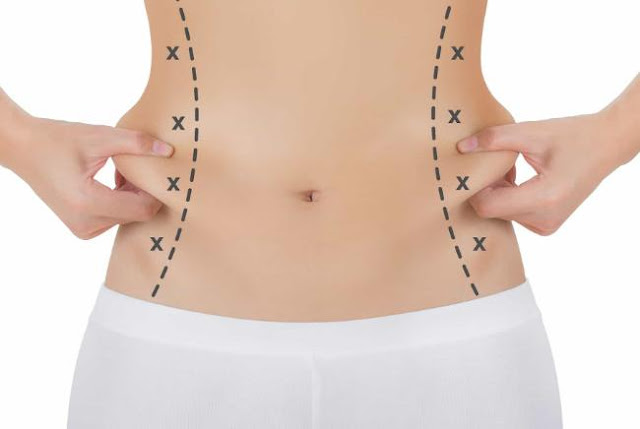 أضرار ومضاعفات عملية شفط الدهون