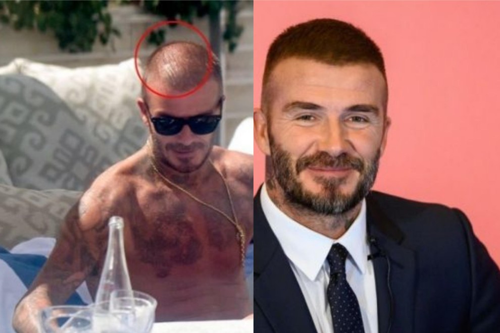 Notizie e sport David Beckham, allerta calvizie? Pochi Notizie e sport David Beckham, allerta calvizie? Pochi
