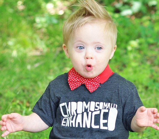 Down syndrome blog