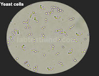 Urine Microscopic - Yeast cells