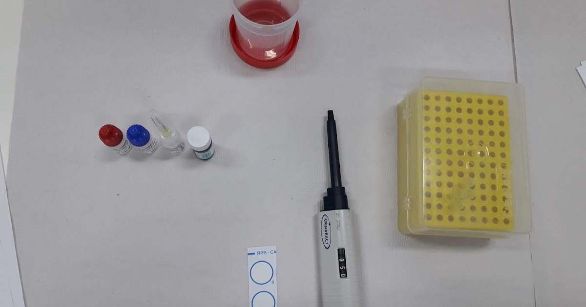 RPR-carbon. Determinación cualitativa de reaginas plasmáticas.