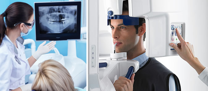 Dream Smile Center, Dr. Jeff Bartlett: The power of panormaic x-rays