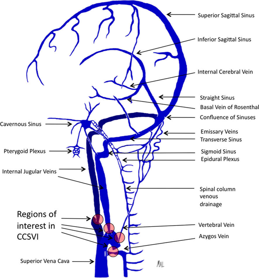 Отток крови от головного мозга. Венозная система головного мозга схема. Внутренняя яремная Вена анатомия кт. Анатомия вен шеи и головы схема. Внутренняя яремная Вена анатомия притоки.