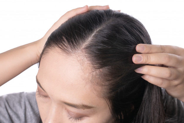 Apa Penyebab Rambut Rontok Berlebihan Because Sharing Is Caring Review Skincare Dan Info Kecantikan