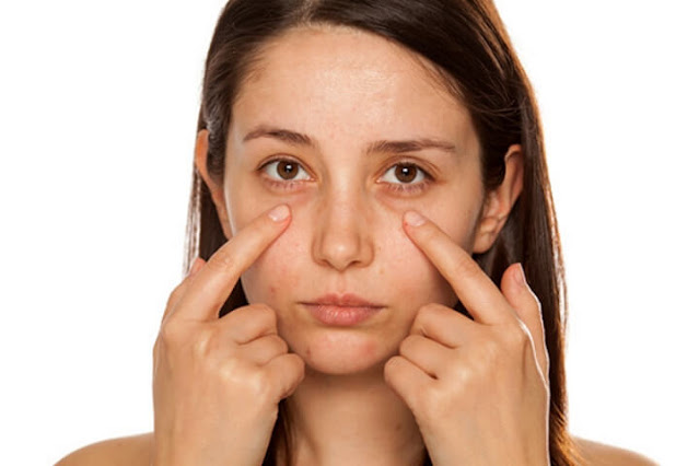 The Most Effective Ways To Cure Dark Circles Under Eyes Naturally