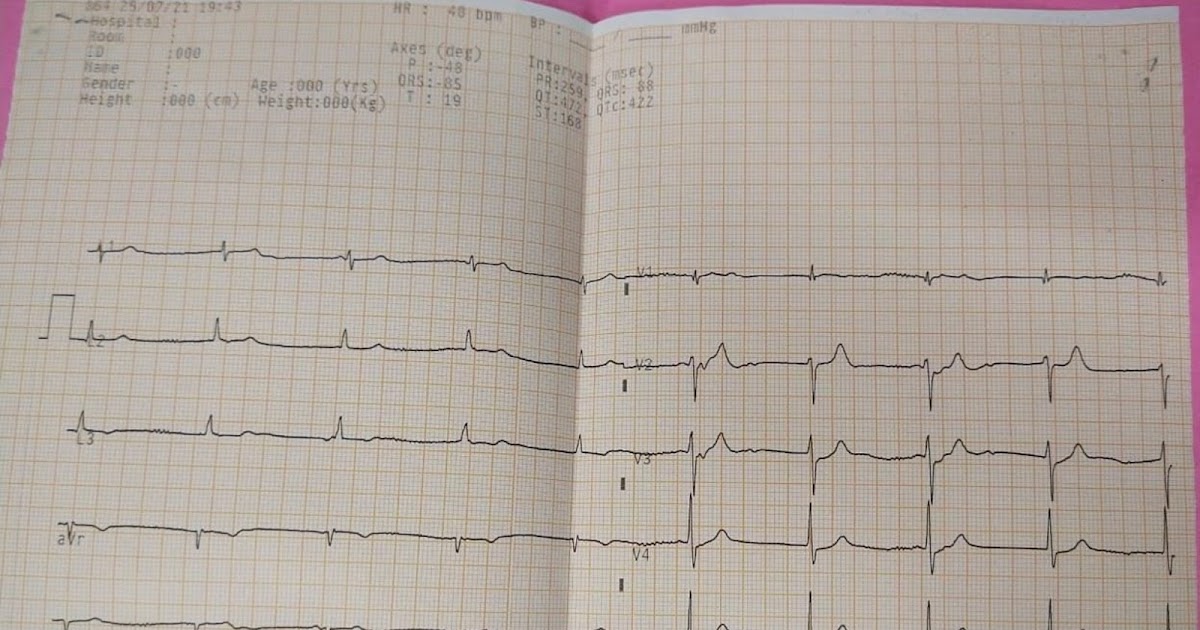 A CASE OF B/L PEDAL EDEMA, ALTERED SENSORIUM AND DYSPNEA.