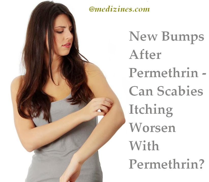 scabies itching after treatment pictures, photos