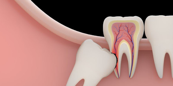 Why are new young teeth growing in adulthood?