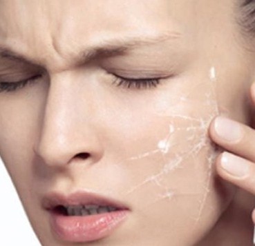 Tempat Specialist Perawatan Pemutih Wajah Jual Kosmetik Aura Glow Magic Beauty Cream Kulit Wajah Mengelupas Karena Obat