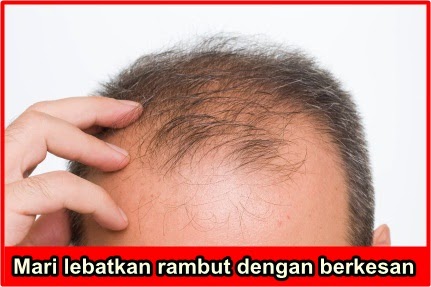 Rambut Nipis Yang Sukar Disisir: Punca dan Penyelesaian