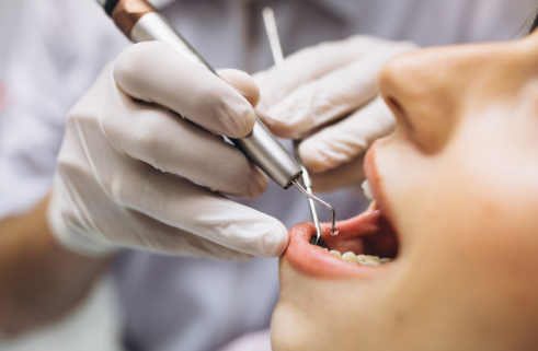 You Must Be Care : What Can Happen When You Don't Have Dental Insurance