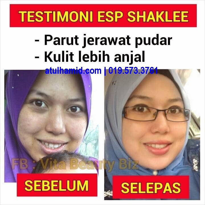 Kebaikan Protein ESP untuk Kulit Sihat dan Cantik Berseri