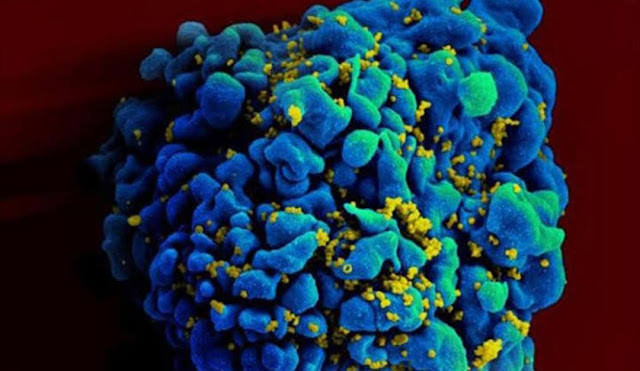 أسباب نقص المناعة 