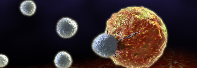 It has recently become apparent that the immune system can cure cancer.