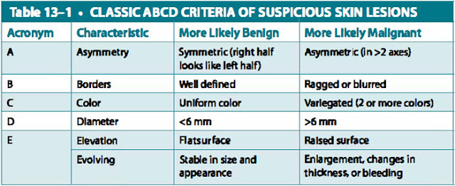 classic abcd criteria of suspicious skin lesions