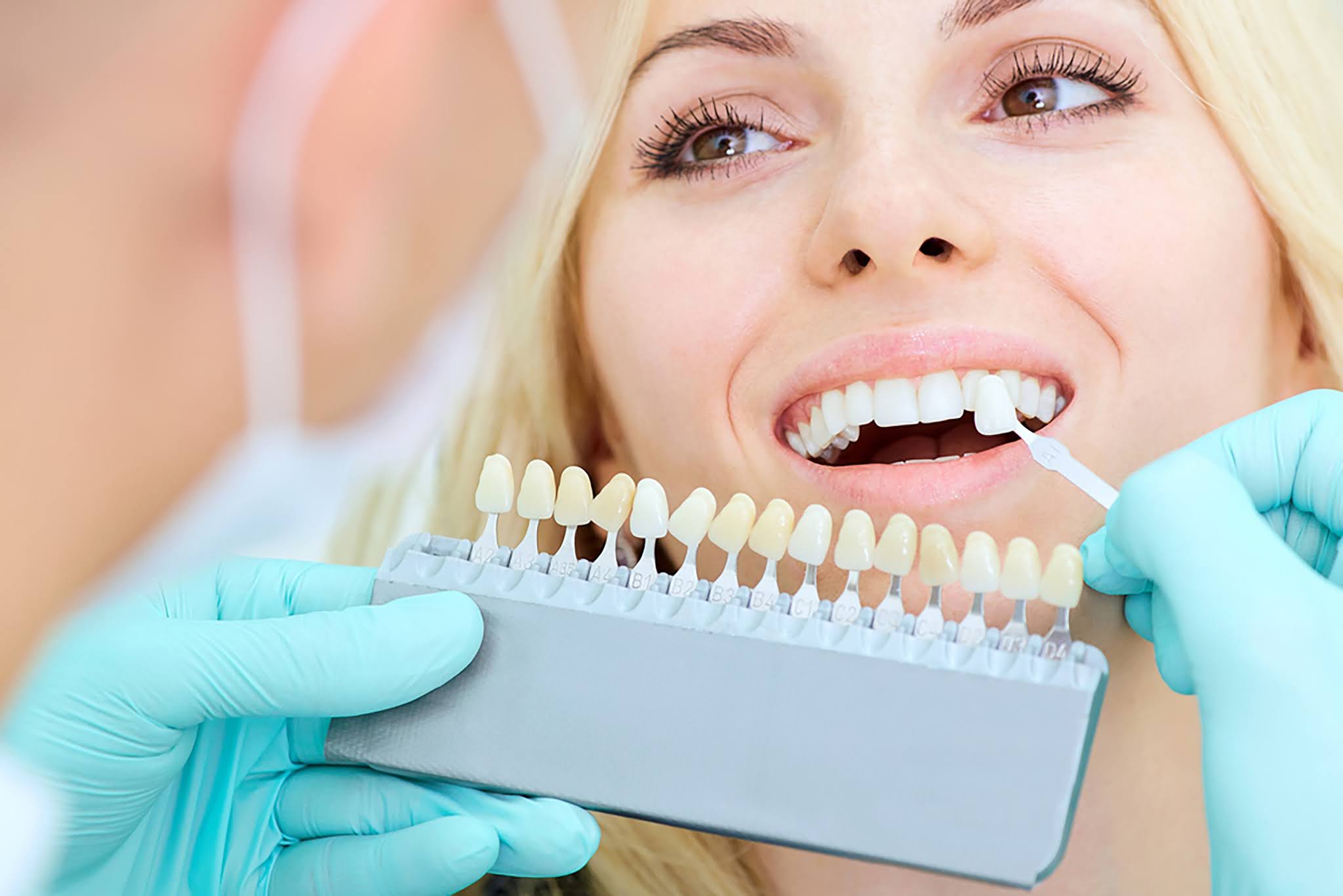 How Can I Whiten My Teeth Without Damaging Them