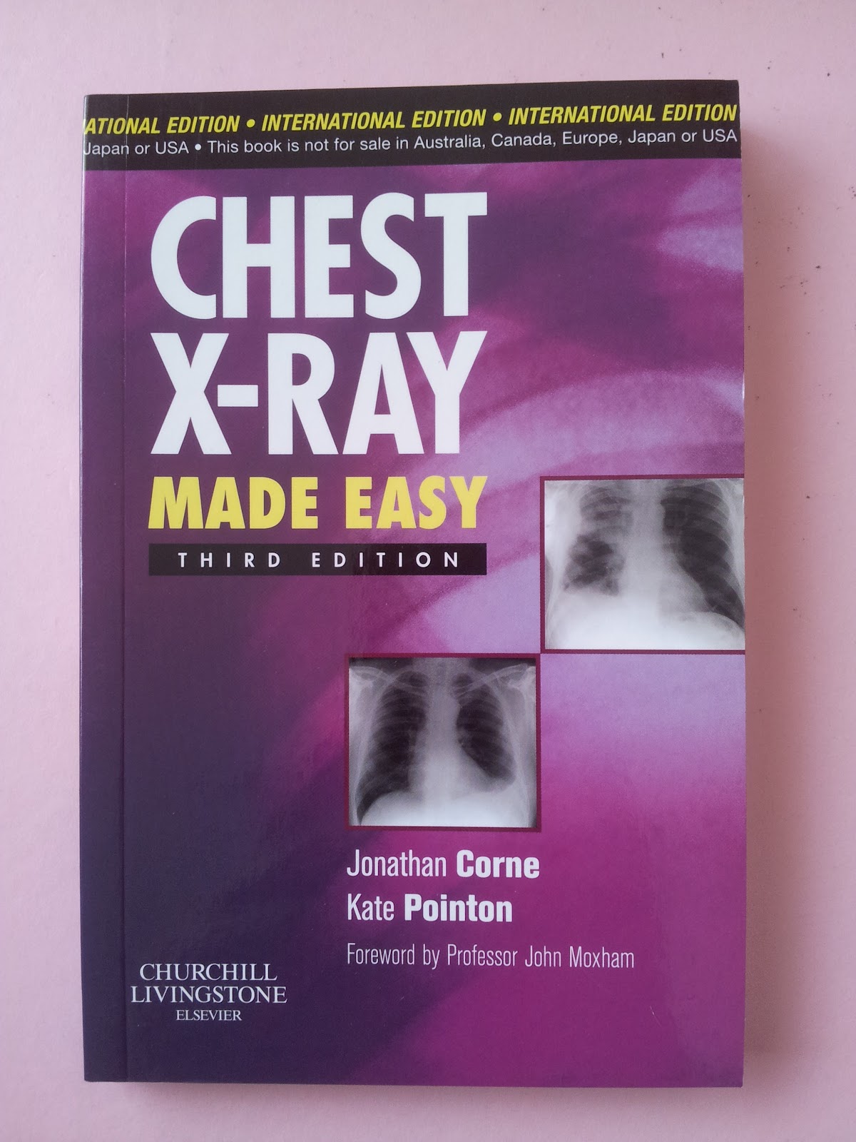 Bukumedik Blogspot (Medical Books Online Shoppe) Chest XRay Made Easy