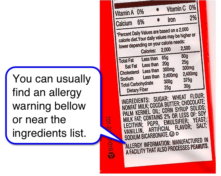 foot talk: Shoe Allergies