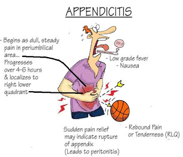 appendix appendicitis