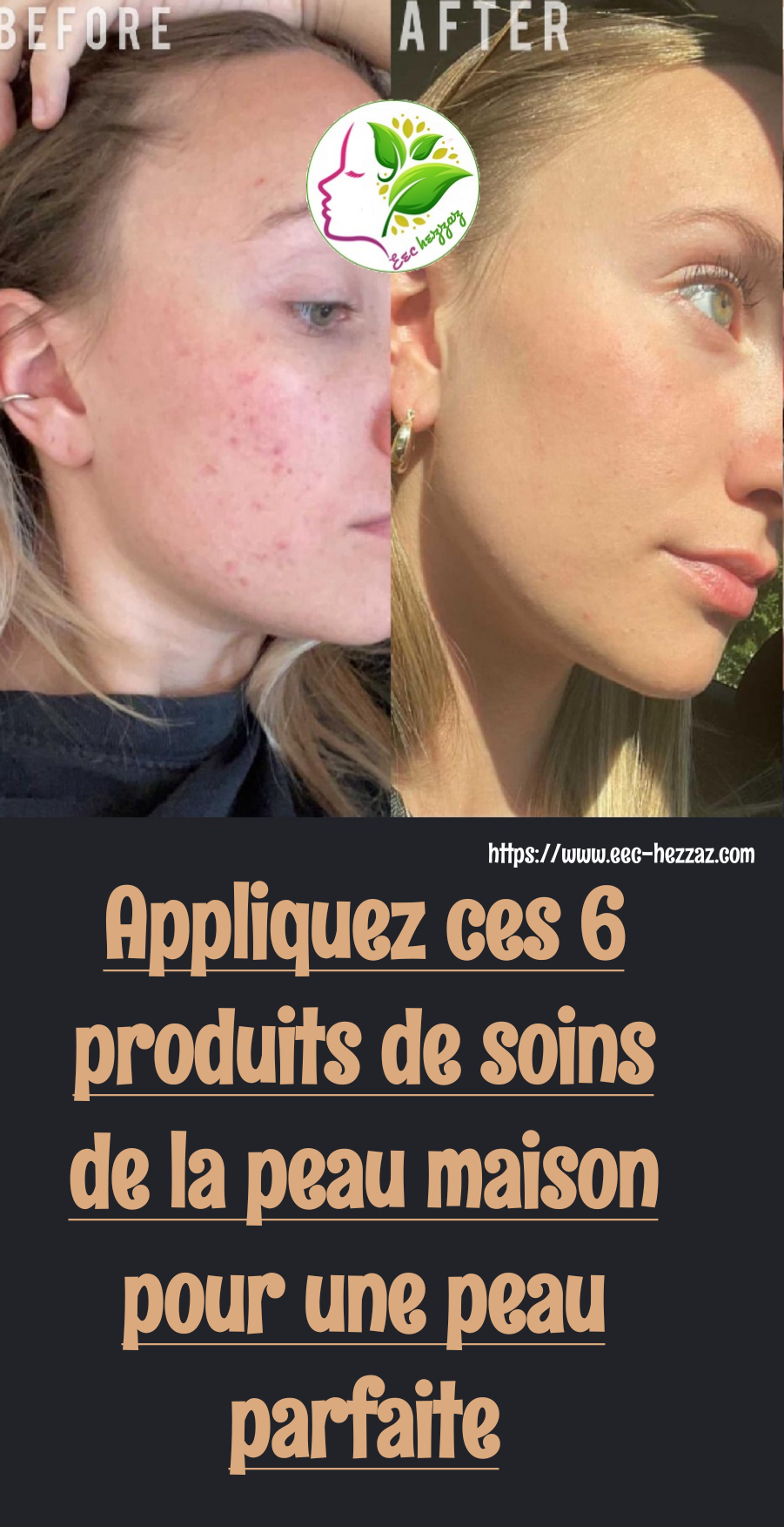 Appliquez ces 6 produits de soins de la peau maison pour une peau parfaite