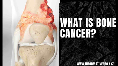 what is bone cancer