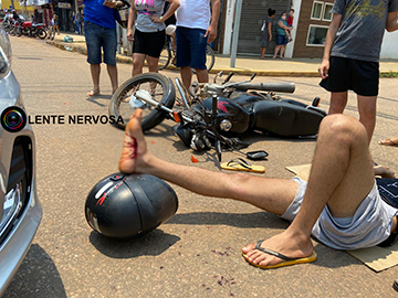 Motociclista sofre grave ferimento em acidente na Avenida Jatuarana 7 Motociclista sofre grave ferimento em acidente na Avenida Jatuarana