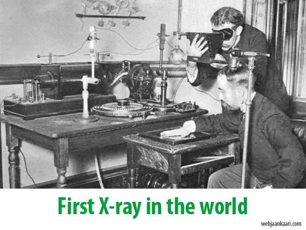 world's first X-ray