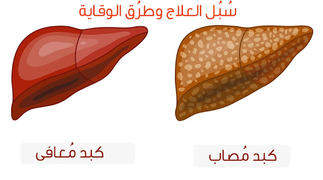 دهون الكبد واضرارها