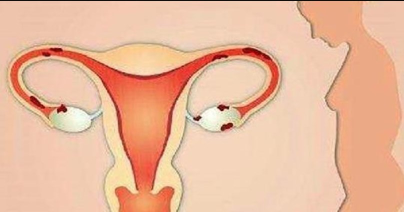 эндометрий во время месячных