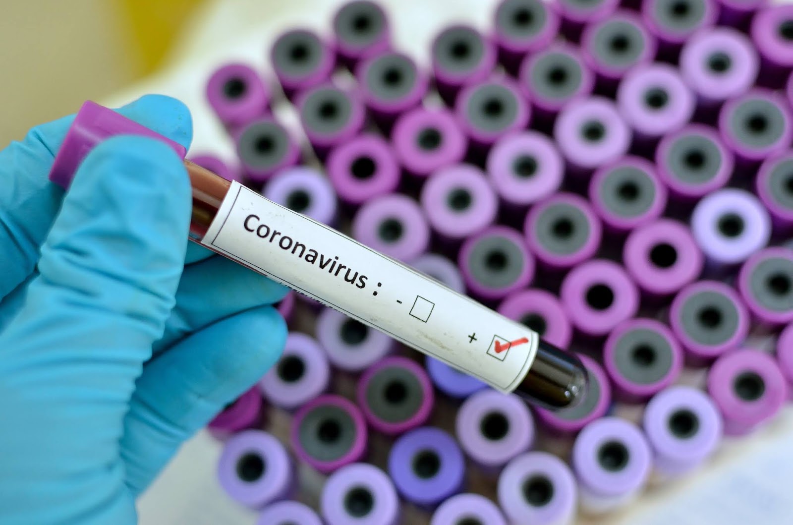 doa berlindung dari coronavirus