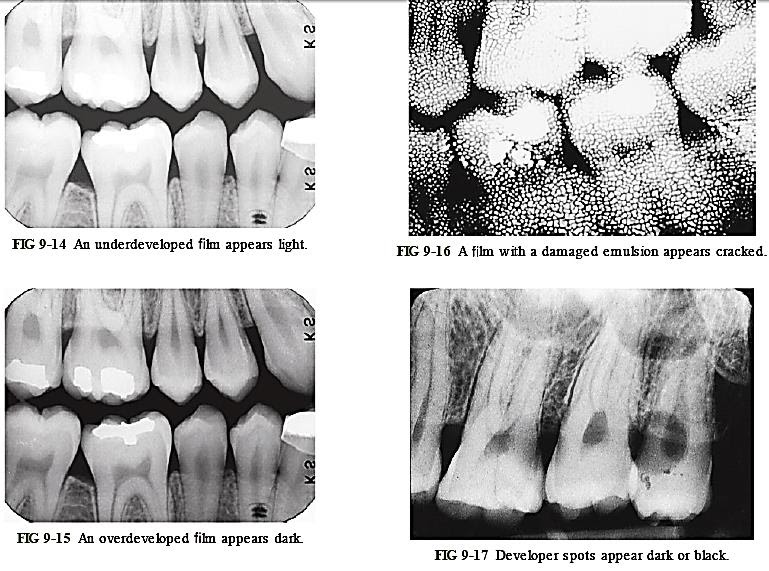 Errors in xray film processing l oral radiology MCQs for dental