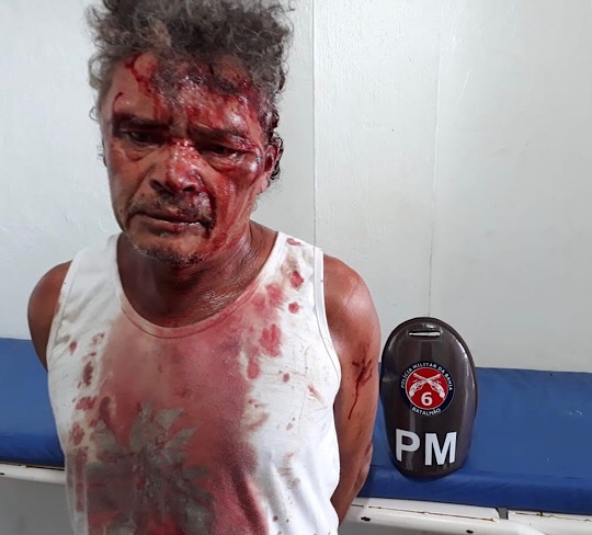 QUEIMADAS: HOMEM DE 63 ANOS ESFAQUEIA ADOLESCENTE DE 15 EM PRAÇA PÚBLICA E É AGREDIDO POR POPULARES QUEIMADAS: HOMEM DE 63 ANOS ESFAQUEIA ADOLESCENTE DE 15 EM PRAÇA PÚBLICA E É AGREDIDO POR POPULARES