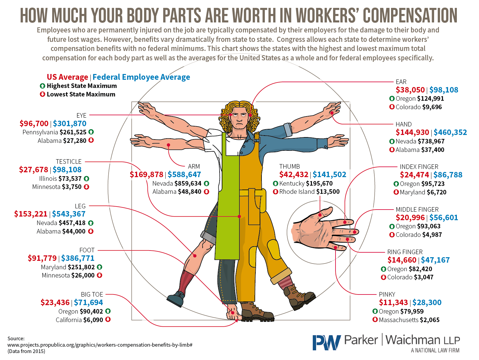 How Much Your Body Parts Are Worth In Workers’ Compensation #