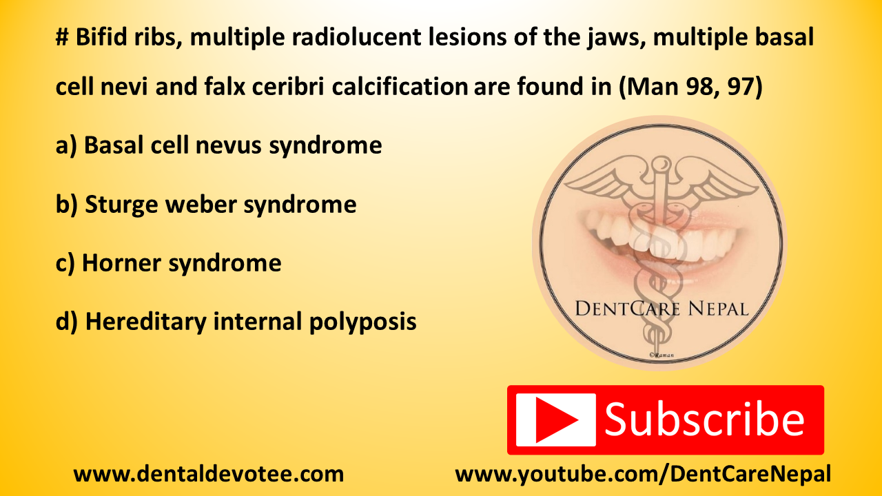 Dentosphere World of Dentistry Bifid ribs and Falx Cerebri Calcification