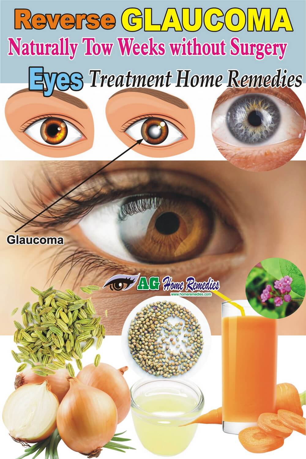 Reverse Naturally Two Weeks Without Surgery