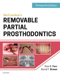 McCracken's Removable Partial Prosthodontics 13th Edition