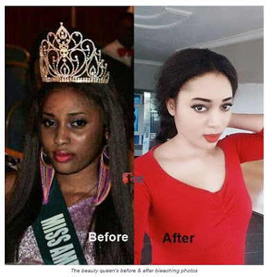 SHOCKING! Before & After Bleaching Photos of Ex Miss Commonwealth Nigeria Will Shock You