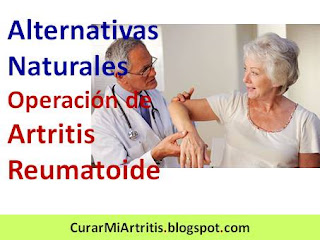 Alternativas-Naturales-Operación-Artritis-Reumatoide