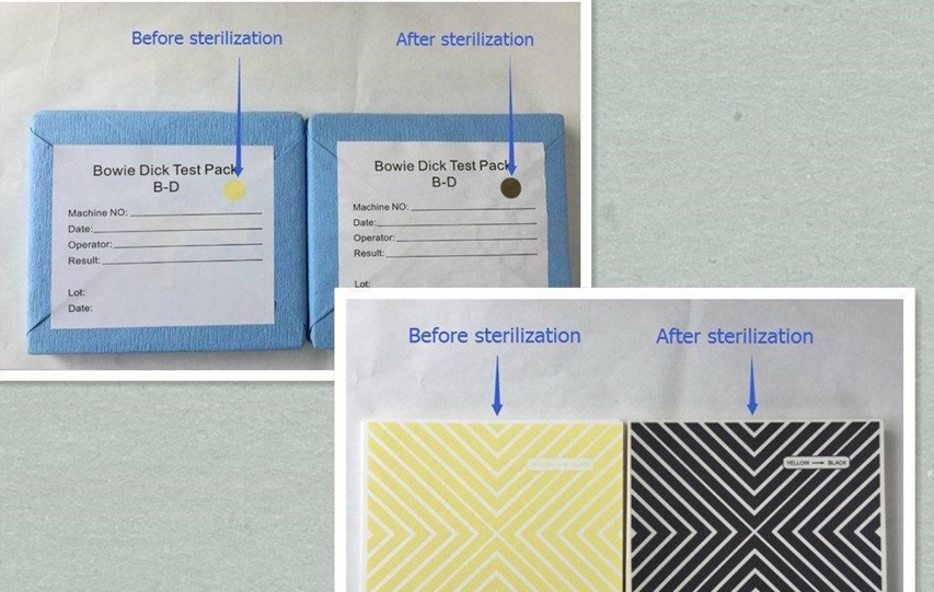 Autoclave (Steam Sterilizer) Detailed Review