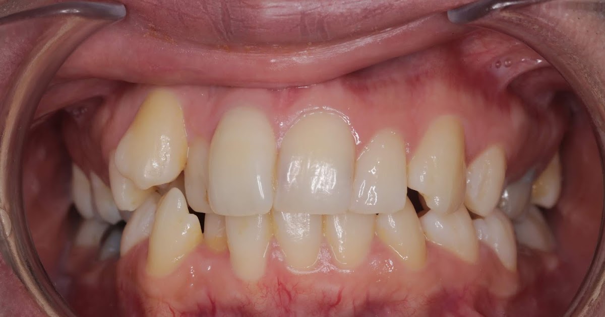 E. BardawilOrthodontistInvisalign Diamond level