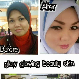 GLOW GLOWING BEAUTY SKIN : DARA ANGGUN, TESTIMONI GLOW GLOWING BEAUTY SKIN ,GLOW GLOWING GOLD SERUM , GLOW GOWING TONER TREATMENT , SET COMBO TERDIRI DARIPADA:  GLOW GLOWING SKINCARE- 1 SET PUTIH COLLAGEN DARA ANGGUN- 1 BOX,GLOW GLOWING SET EXCLUSIVE  TERBARU 5 in 1 