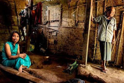 Saimun ha vissuto con una gamba incastrata in una morsa di legno per cinque anni
