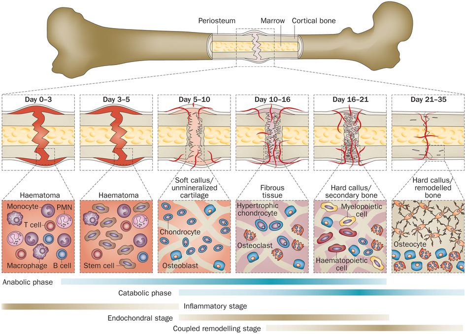 Tempoh Penyembuhan Tulang patah akufisio.blogspot