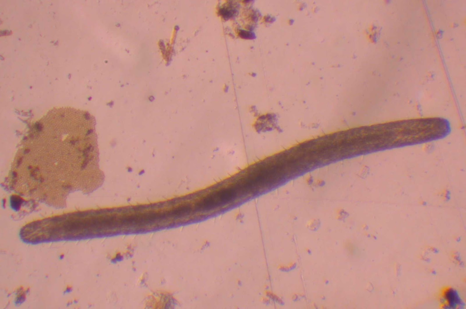 Gastrotricha Dunia Hewan