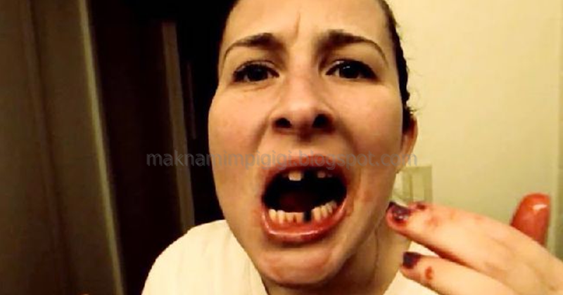 99 Arti Mimpi Gigi Tercabut Bagian Atas Dan Bawah Menurut Primbon Jawa Dan Tafsir  Islam Paling Lengkap - Mimpi Gigi