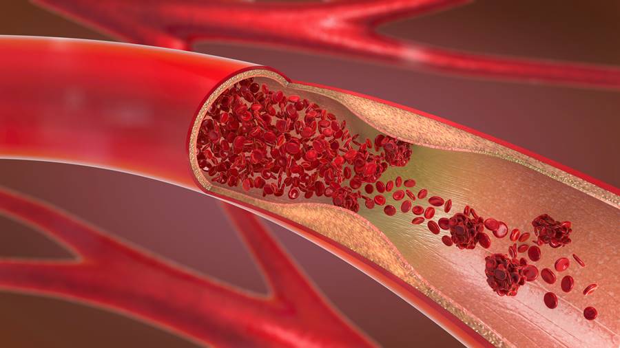 Calcificaciones y nutrición: juanetes y espolón