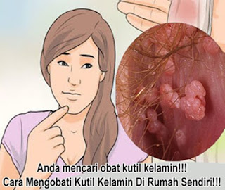 Obat Luka Pada Kutil Kelamin, obat kutil pada kemaluan pria, obat mengempeskan benjolan kutil kelamin, bahaya kutil kelamin pada wanita, gambar kutil kelamin atau kutil di kemaluan pd wanita, obat pereda nyeri kutil kelamin, cara mengobati kutil kelamin atau kutil di kemaluan pd wanita, obat kutil kelamin alami untuk ibu menyusui, obat yang bisa menyembuhkan kutil kelamin, nama obat kutil kelamin di apotek, tumbuh kutil di kemaluan saat hamil