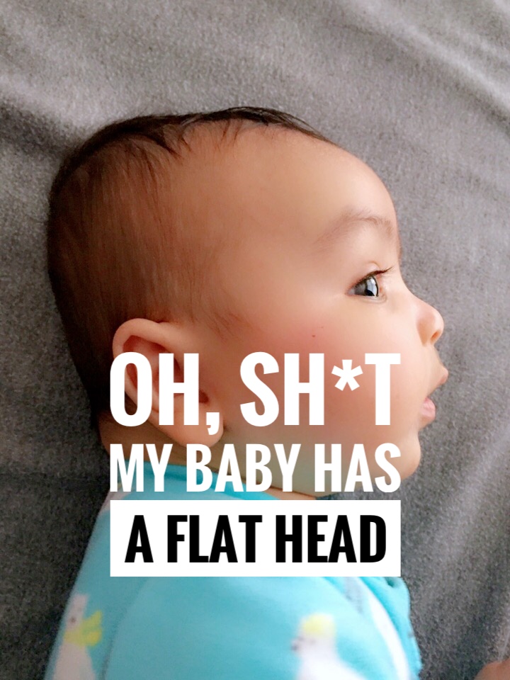 T h e M i l l e n n i a l M o m My Baby's Head is Flat!