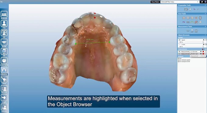 DENTAL SOFTWARE: Planmeca Romexis Model Analyser